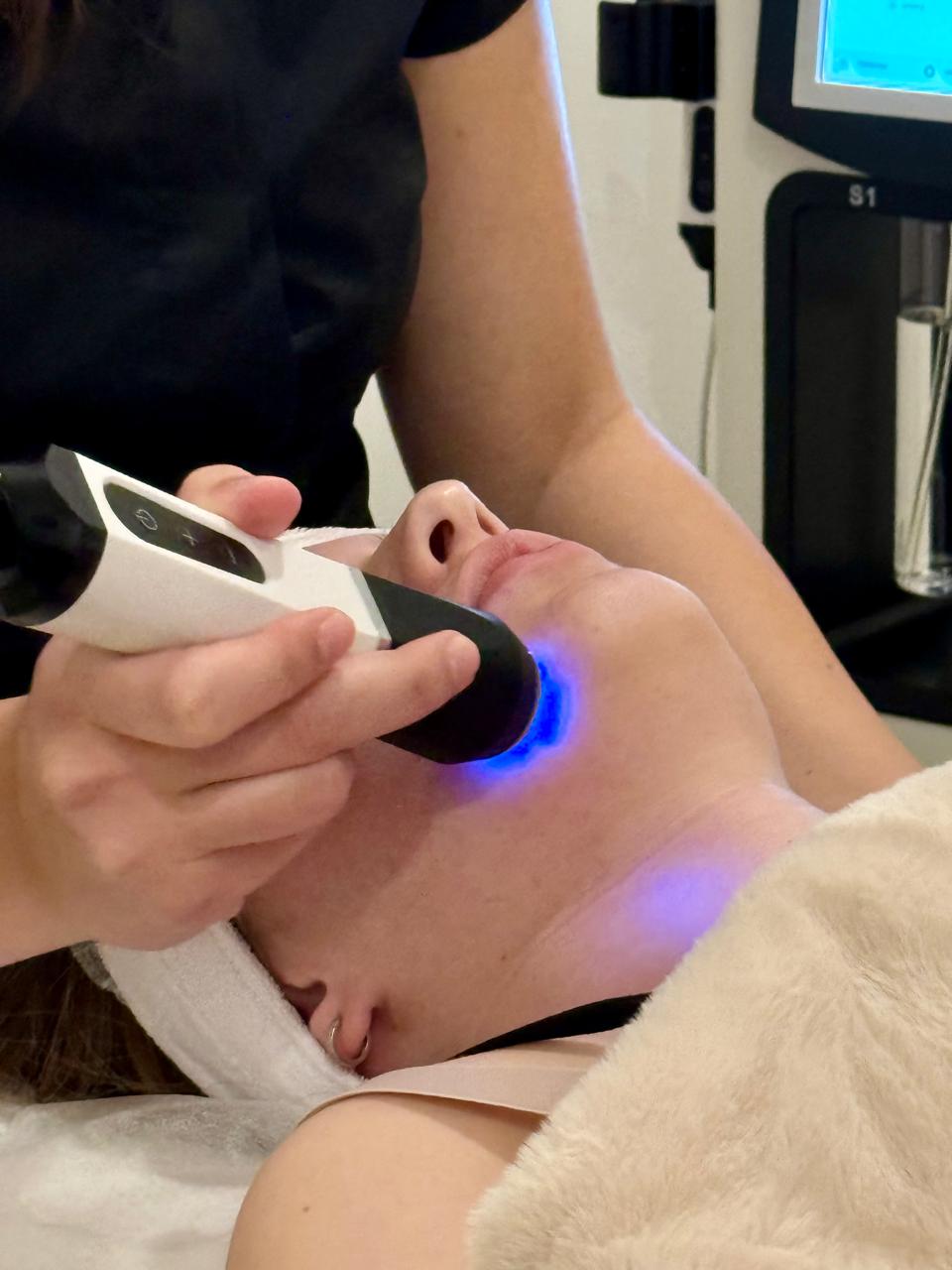 HIFU raffermissement et lifting non-invasif 3